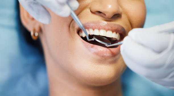 Best Emergency Dental Care for Sports Injuries in Keowee Key, SC